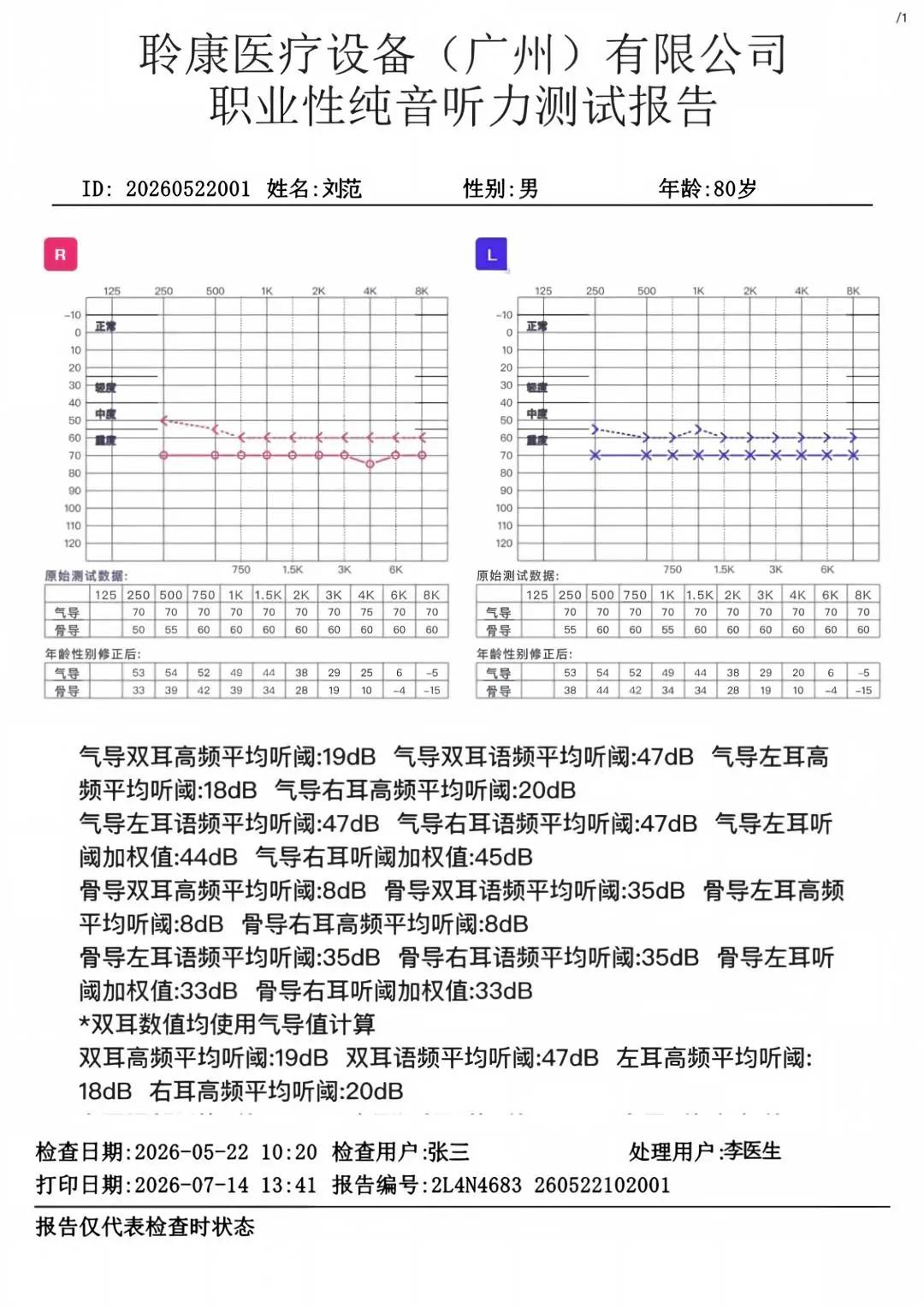 GB 23466‑2025新国标实施｜职业听力健康守护刻不容缓(图3)